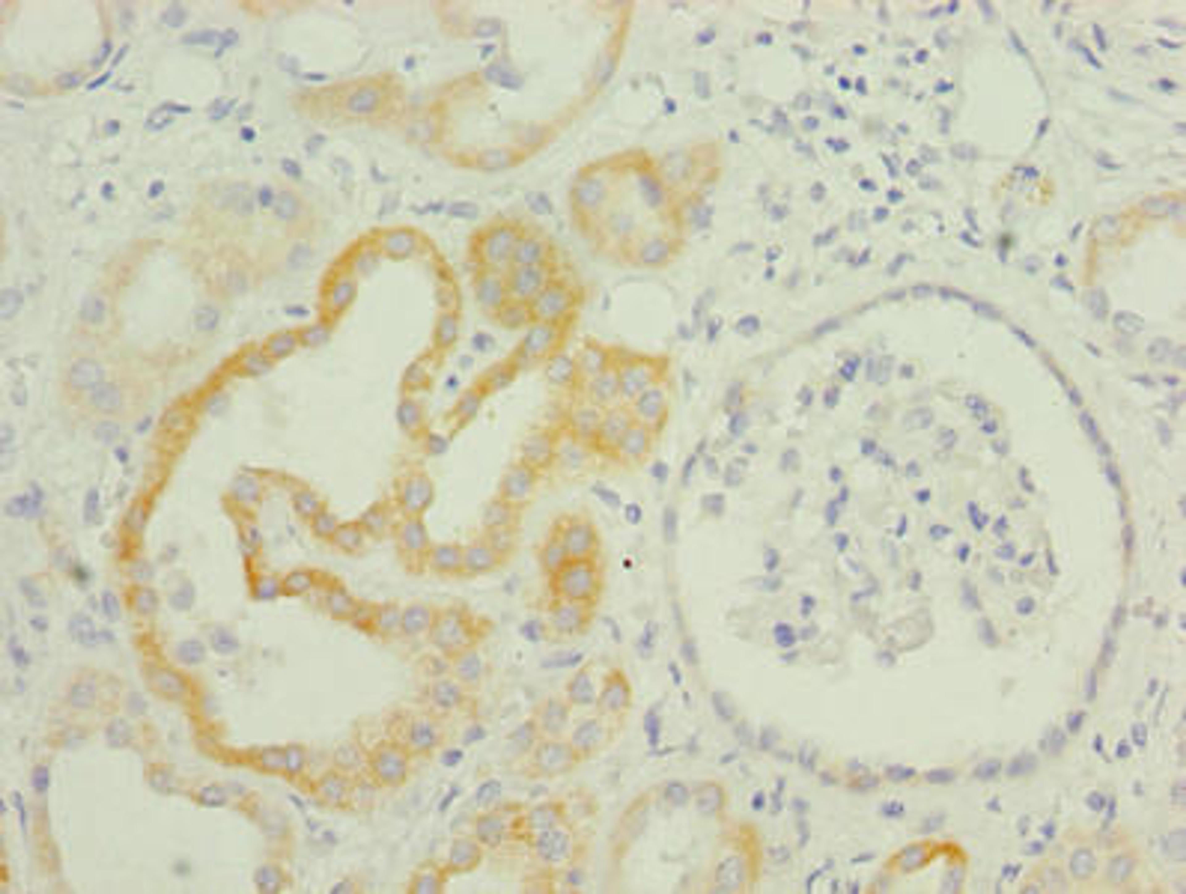 Immunohistochemistry of paraffin-embedded human kidney tissue using CSB-PA023863LA01HU at dilution of 1:100