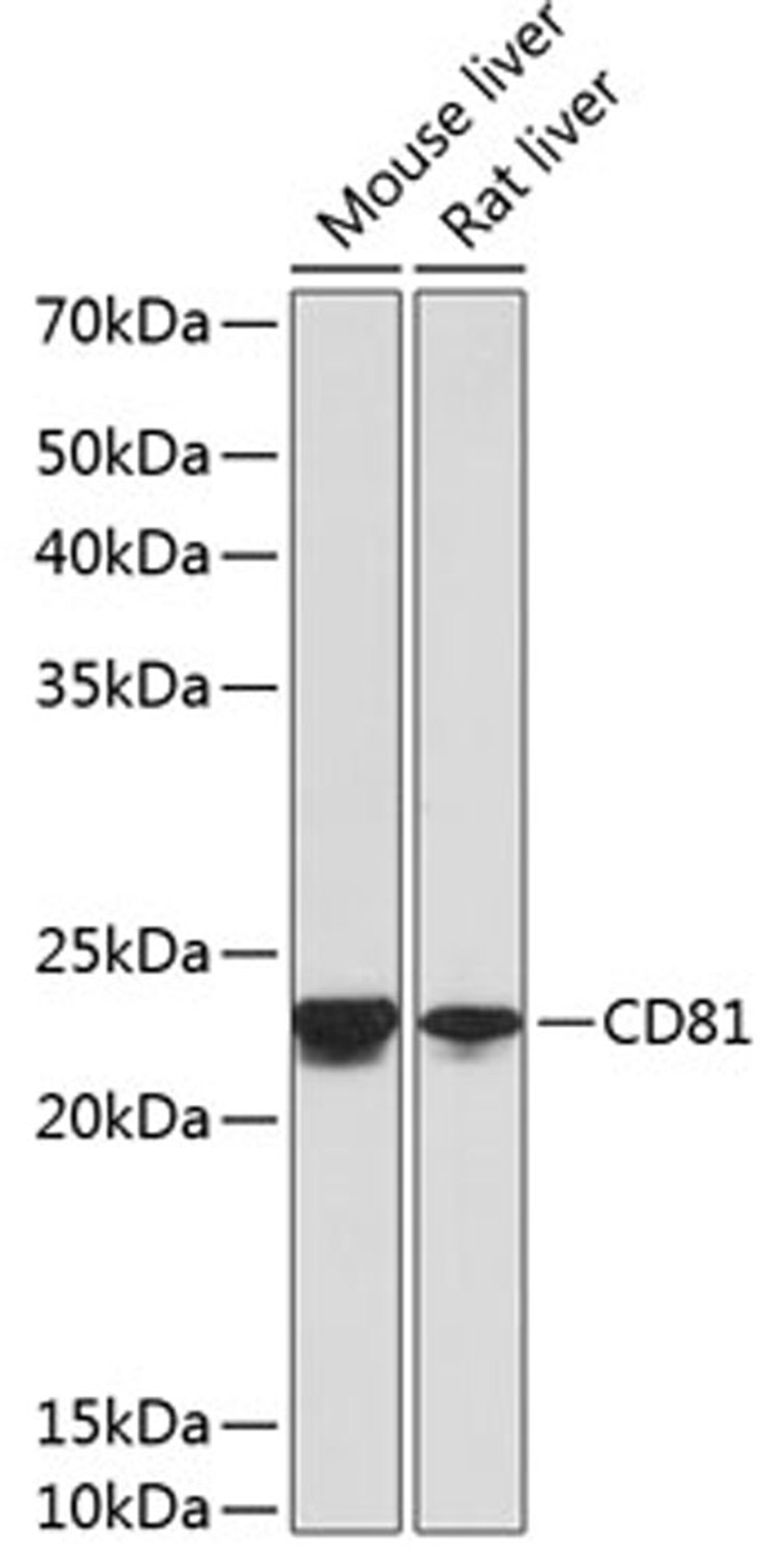 Western blot - CD81 antibody (A4863)