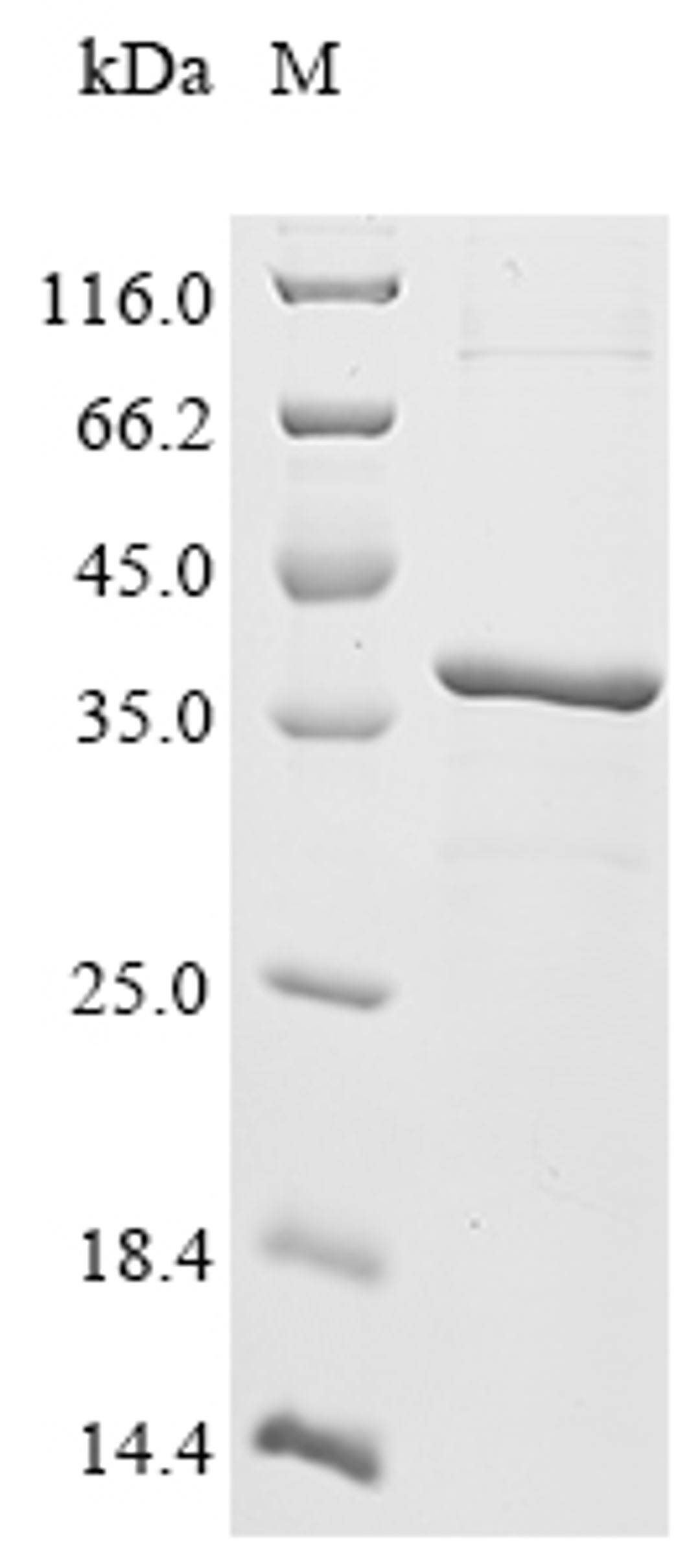 (Tris-Glycine gel) Discontinuous SDS-PAGE (reduced) with 5% enrichment gel and 15% separation gel.