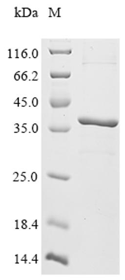(Tris-Glycine gel) Discontinuous SDS-PAGE (reduced) with 5% enrichment gel and 15% separation gel.