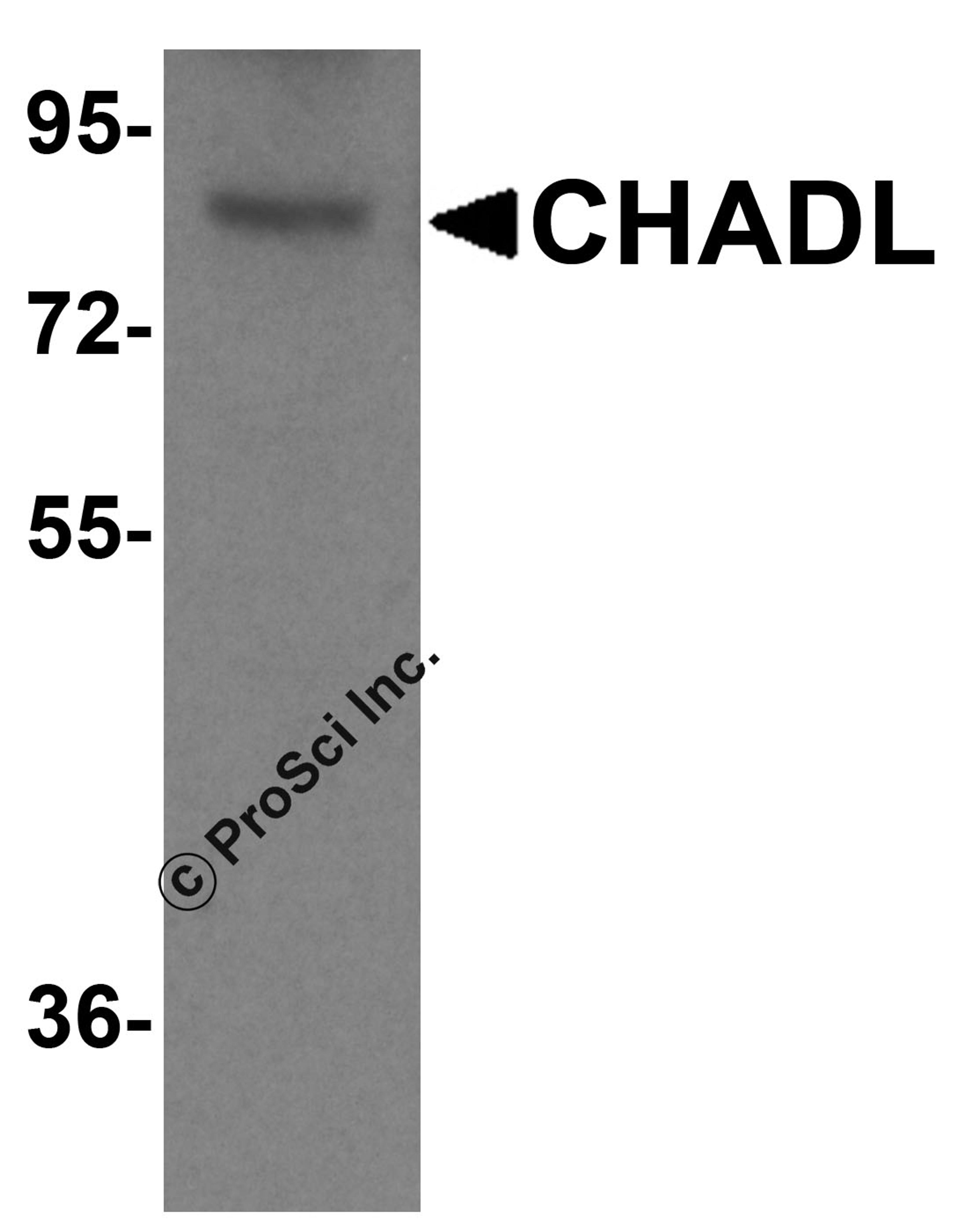 Western blot analysis of CHADL in mouse kidney tissue lysate with CHADL antibody at (A) 1 and (B) 2 μg/ml.