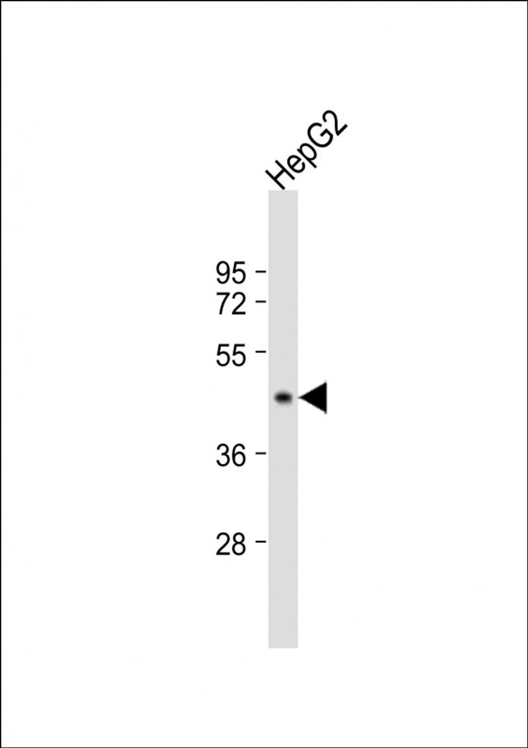 Western Blot at 1:1000 dilution + HepG2 whole cell lysate Lysates/proteins at 20 ug per lane.