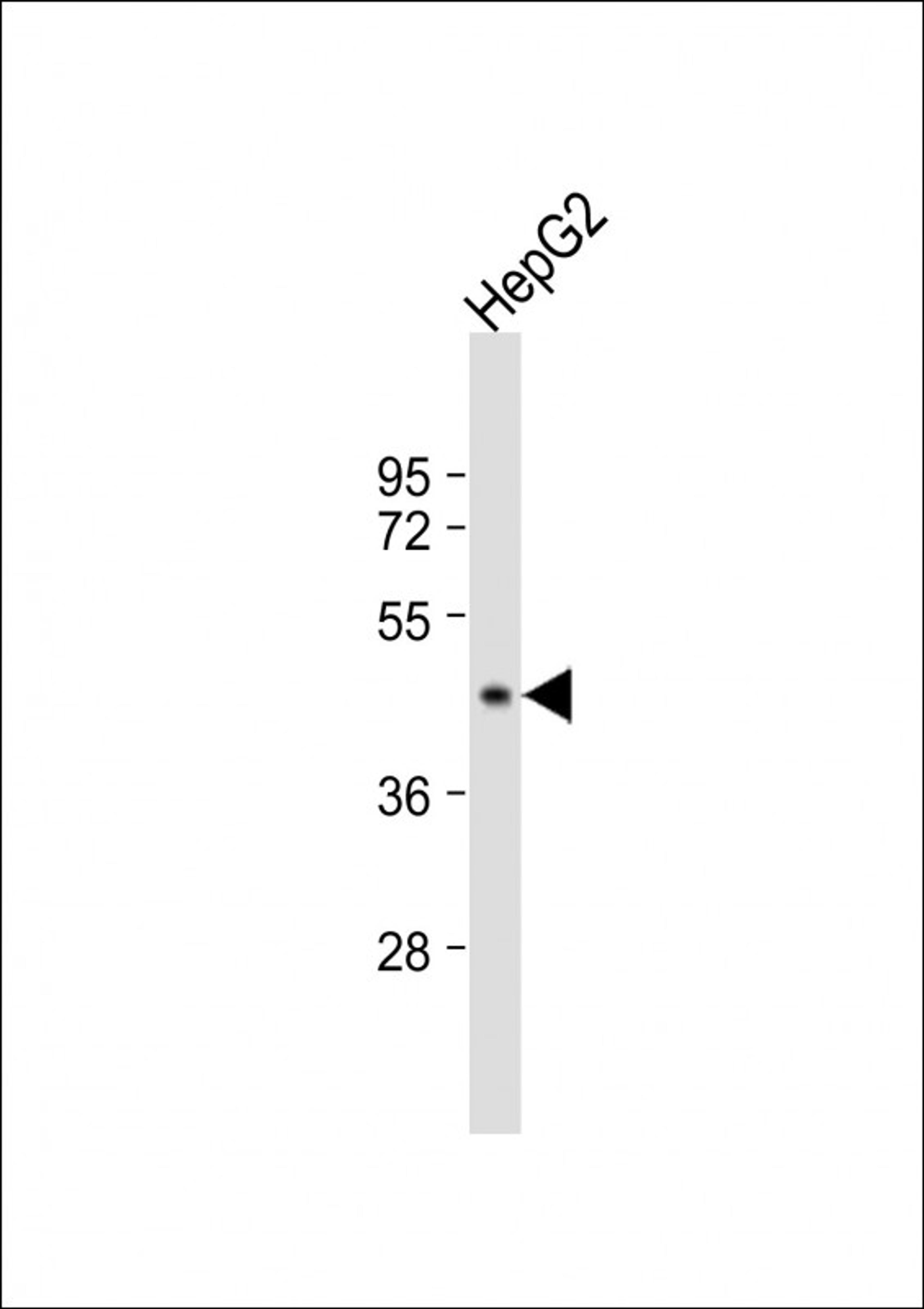 Western Blot at 1:1000 dilution + HepG2 whole cell lysate Lysates/proteins at 20 ug per lane.