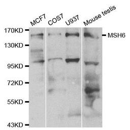 Western blot analysis of extracts of various cell lines using MSH6 antibody