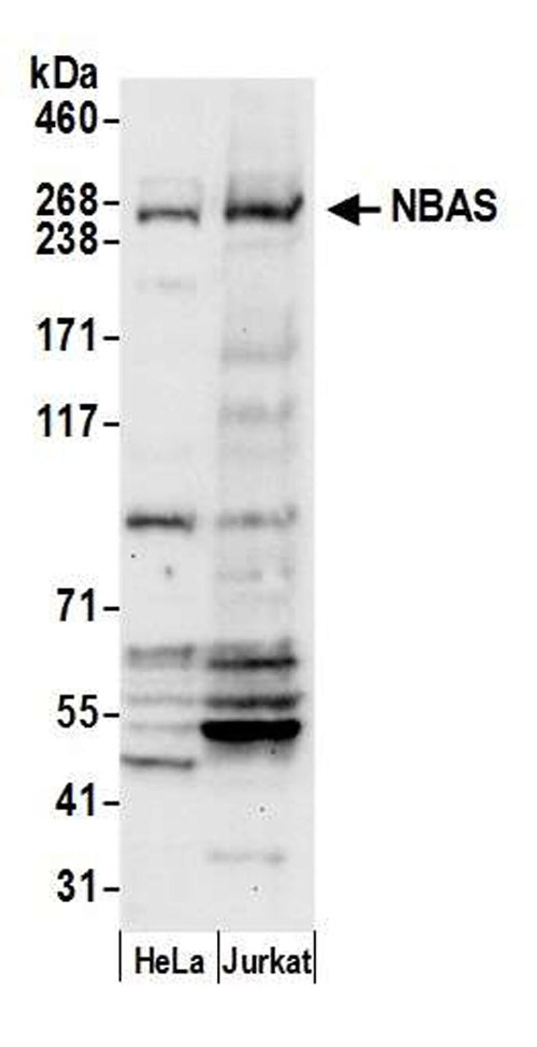 Detection of human NBAS by WB.