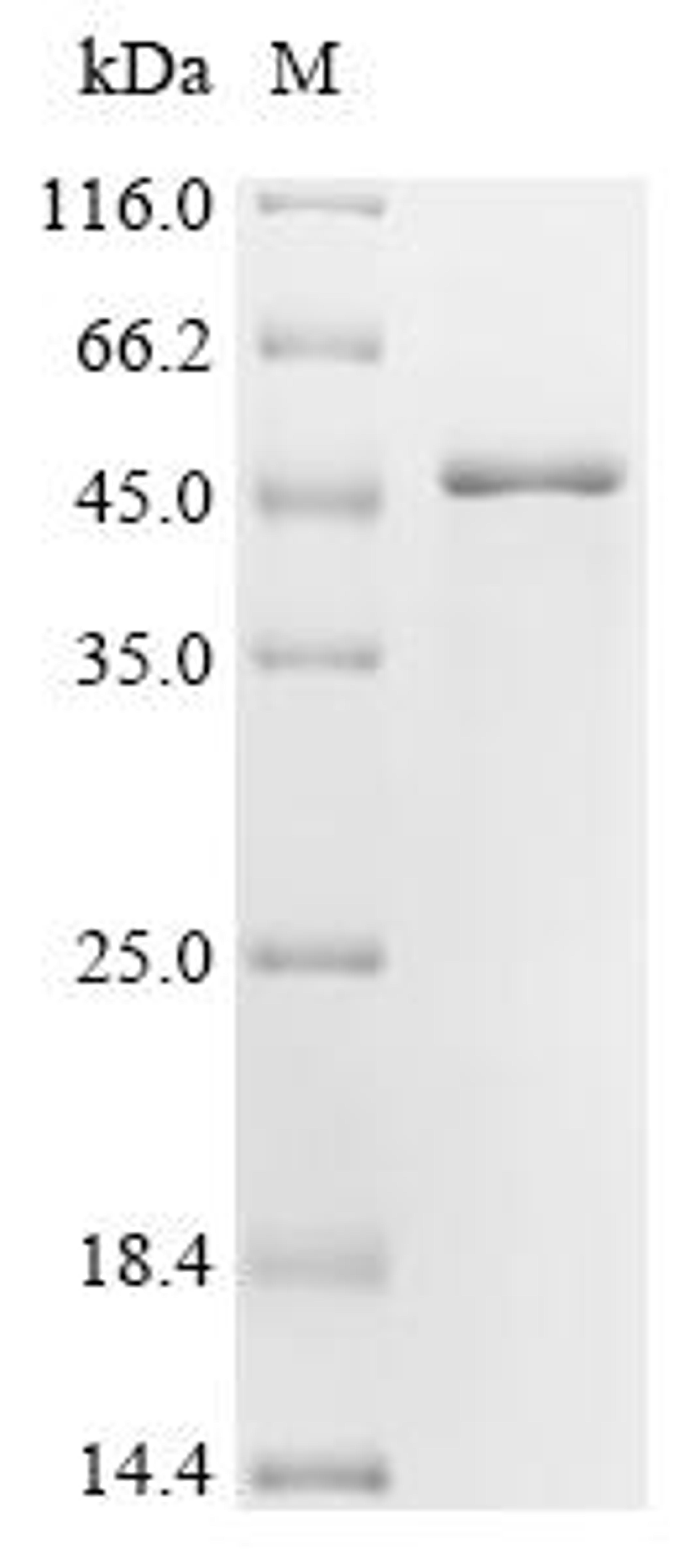 (Tris-Glycine gel) Discontinuous SDS-PAGE (reduced) with 5% enrichment gel and 15% separation gel.