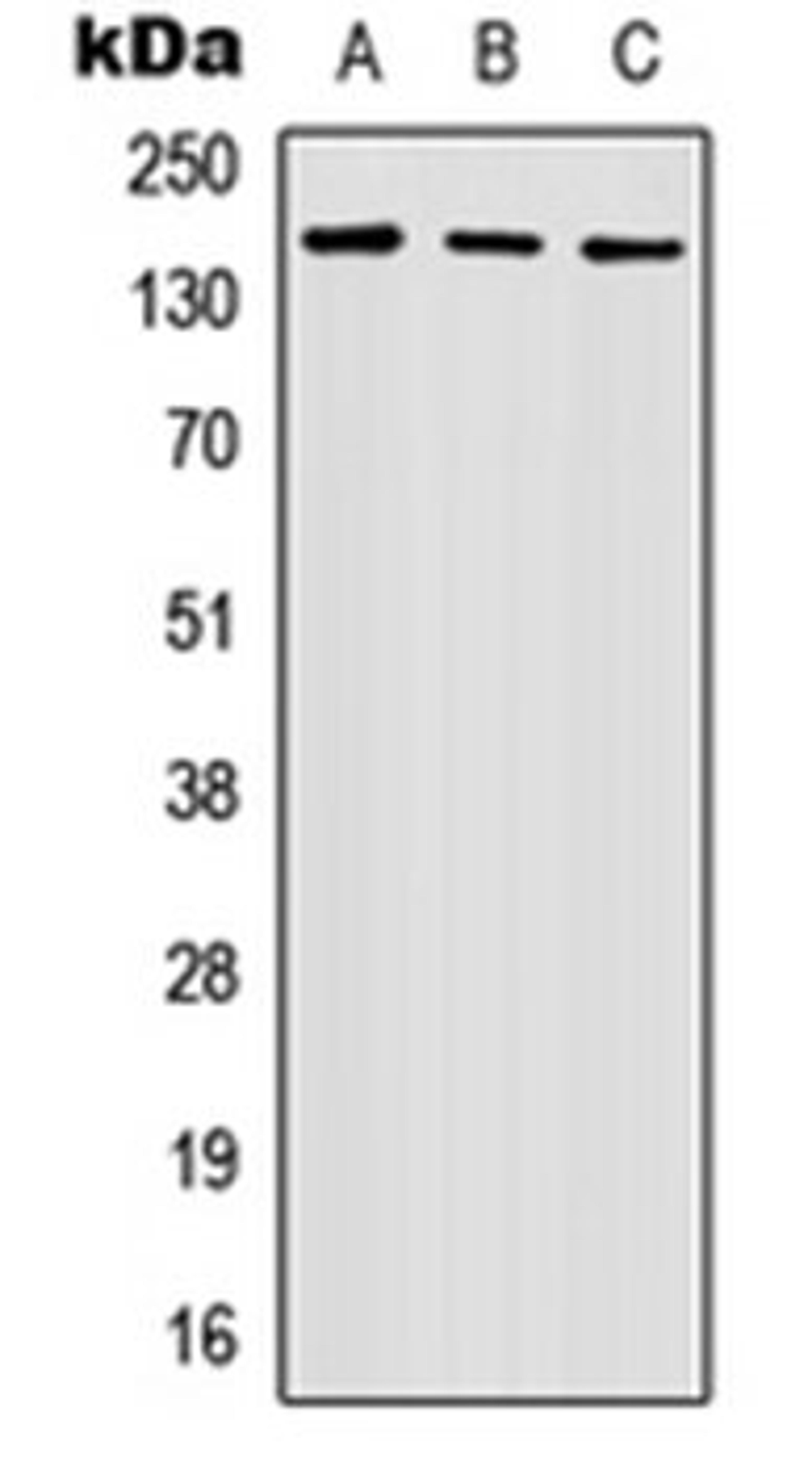 Western blot analysis of HEK293T (Lane 1), Raw264.7 (Lane 2), PC12 (Lane 3) whole cell lysates using Nidogen 2 antibody