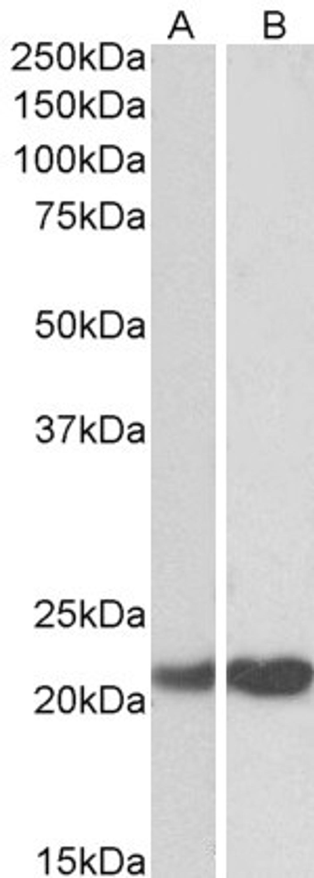 46-161 (0.01ug/ml) staining of Human Cerebellum (A) and Mouse Testes (B) lysate (35ug protein in RIPA buffer). Primary incubation was 1 hour. Detected by chemiluminescence.