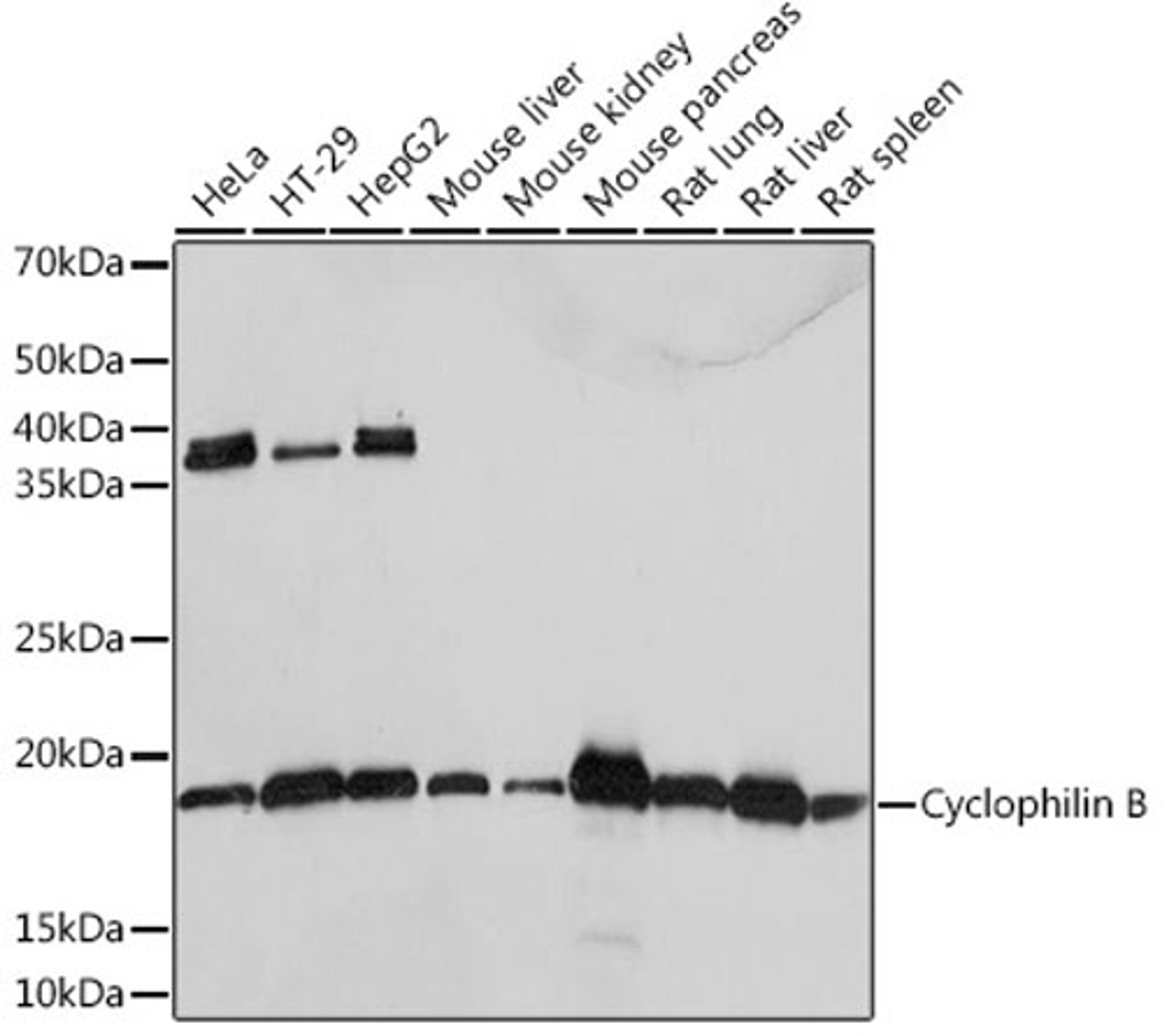 Western blot - Cyclophilin B  Rabbit mAb (A4861)