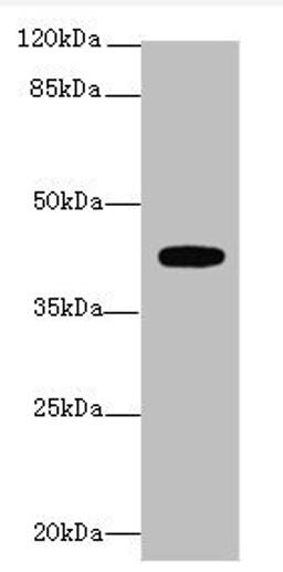 Western blot analysis of Mouse kidney tissue using LPAR4 antibody