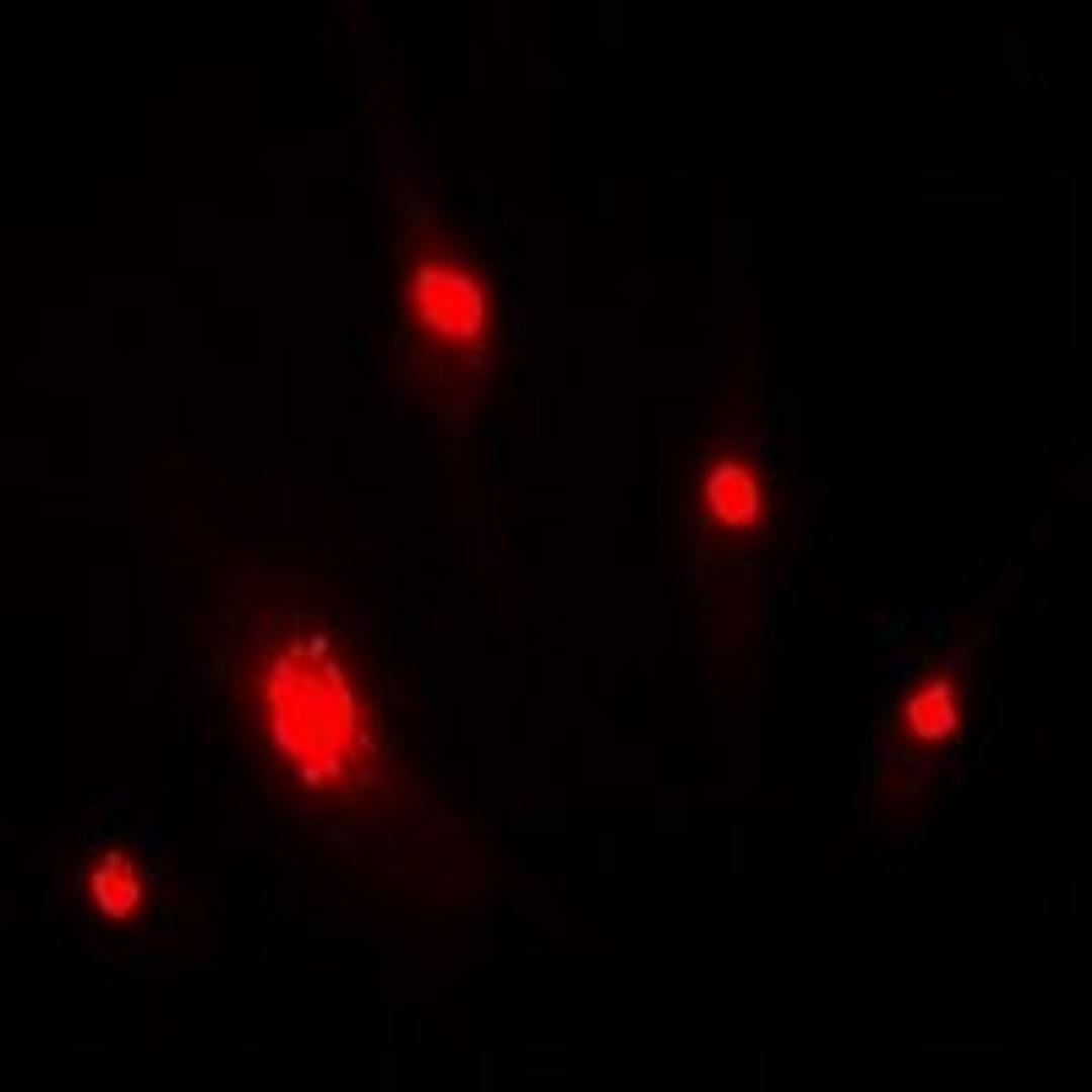 Immunofluorescent analysis of MCF7 cells using DDB2 antibody