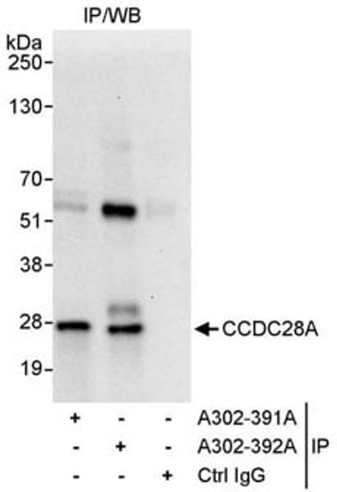 Detection of human CCDC28A by western blot of immunoprecipitates.