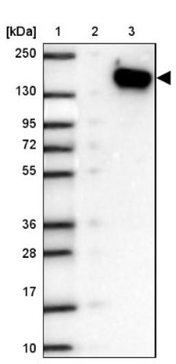 Western Blot: SKIV2L Antibody [NBP2-47274] - Lane 1: Marker [kDa] 250, 130, 95, 72, 55, 36, 28, 17, 10.  Lane 2: Negative control (vector only transfected HEK293T lysate).  Lane 3: Over-expression lysate (Co-expressed with a C-terminal myc-DDK tag (3.1 kDa) in mammalian HEK293T cells).