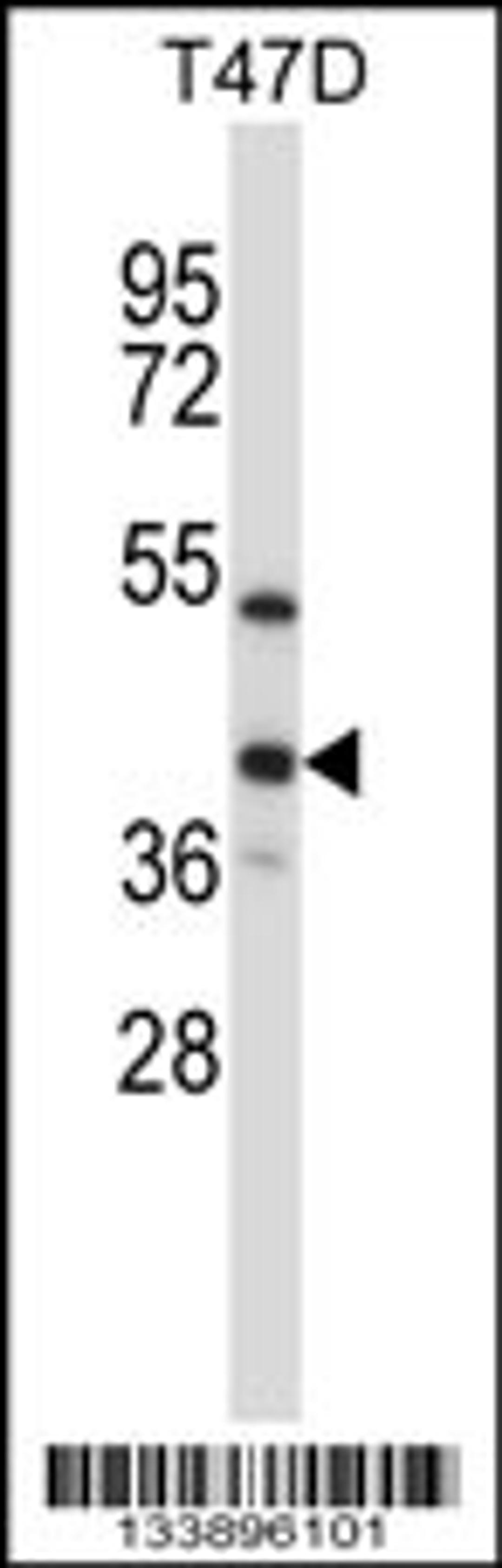 Western blot analysis in T47D cell line lysates (35ug/lane).