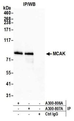 Detection of human MCAK by western blot of immunoprecipitates.