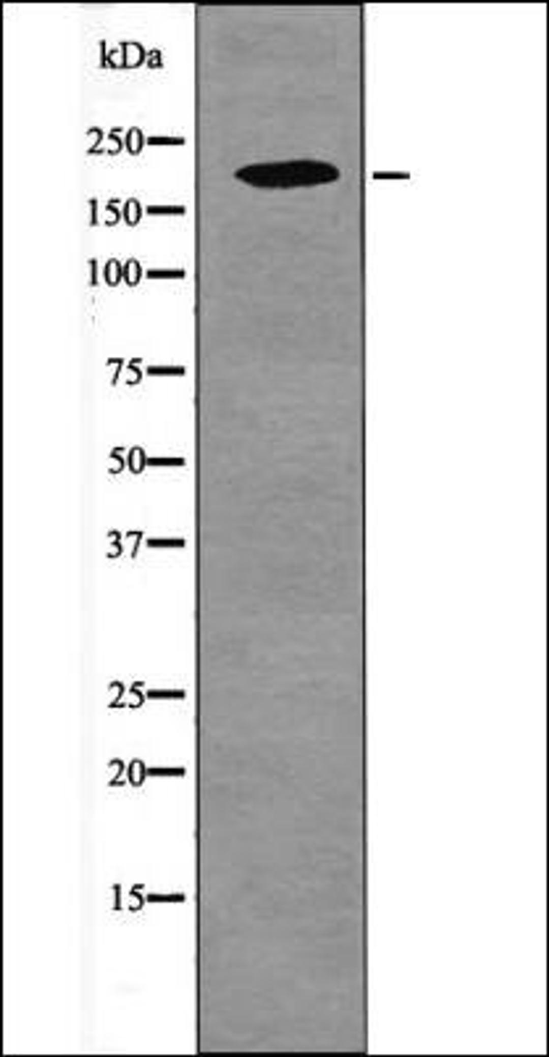 Western blot analysis of UV treated 293 whole cell lysates using PDGFRB -Phospho-Tyr1009- antibody