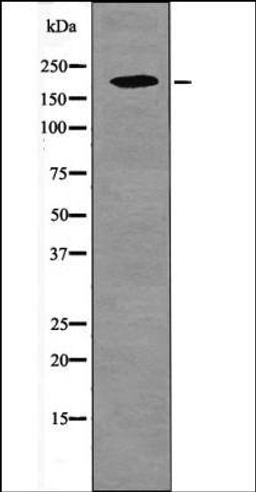 Western blot analysis of UV treated 293 whole cell lysates using PDGFRB -Phospho-Tyr1009- antibody