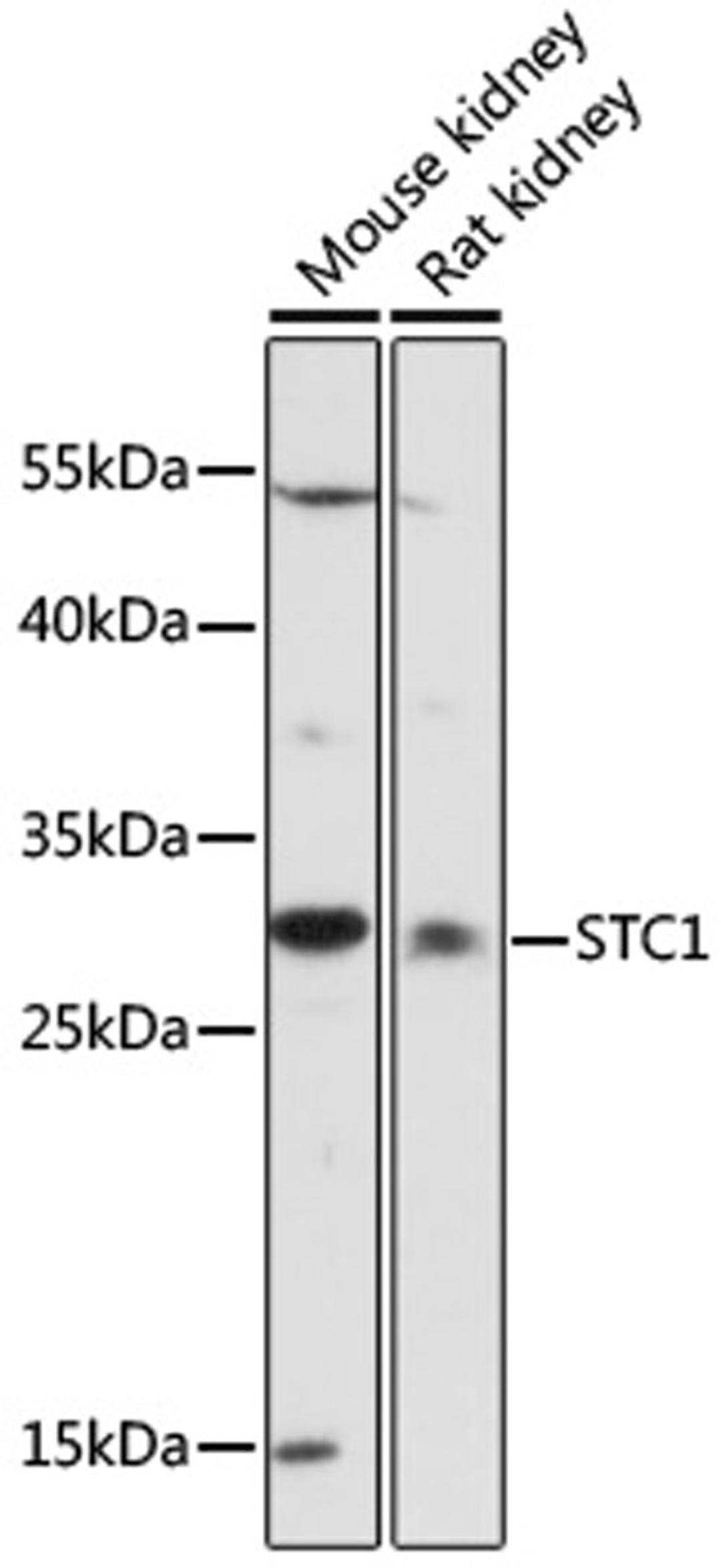 Western blot - STC1 antibody (A16976)