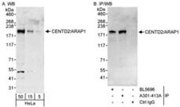 Detection of human CENTD2/ARAP1 by western blot and immunoprecipitation.