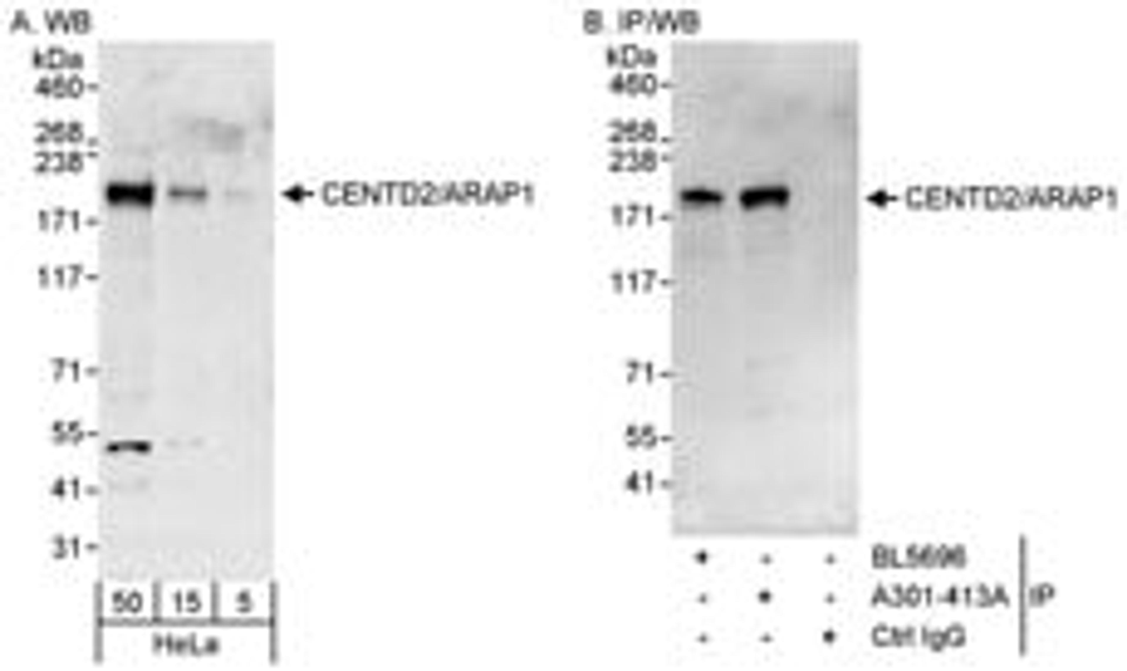 Detection of human CENTD2/ARAP1 by western blot and immunoprecipitation.