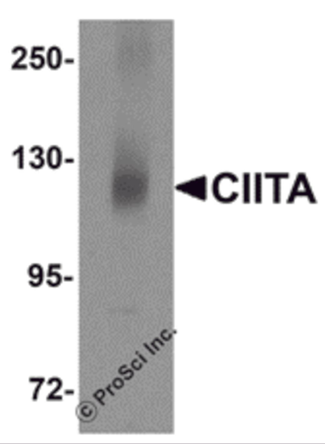 Western blot analysis of CIITA in rat brain tissue lysate with CIITA antibody at 1 μg/mL.