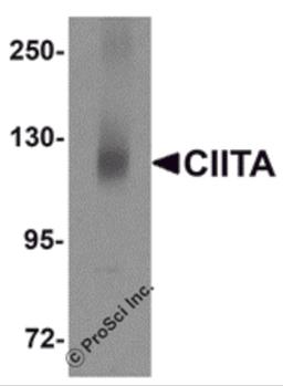 Western blot analysis of CIITA in rat brain tissue lysate with CIITA antibody at 1 μg/mL.