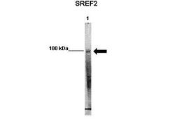 Antibody used in WB on mouse glomerular endothelial at 1:1000.