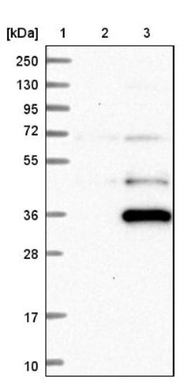 Western Blot: C7orf36 Antibody [NBP1-81830] - Lane 1: Marker [kDa] 250, 130, 95, 72, 55, 36, 28, 17, 10<br/>Lane 2: Negative control (vector only transfected HEK293T lysate)<br/>Lane 3: Over-expression lysate (Co-expressed with a C-terminal myc-DDK tag (~3.1 kDa) in mammalian HEK293T cells, LY412614)