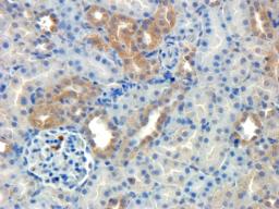 Immunohistochemical staining of rat kidney tissue using anti-HECTD1 (dilution at 1:200)