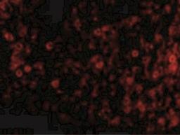 Immunofluorescence: PKR Antibody [NBP1-77266] - Immunofluorescence of PKR in Rat Lung tissue with PKR antibody at 20 ug/mL.