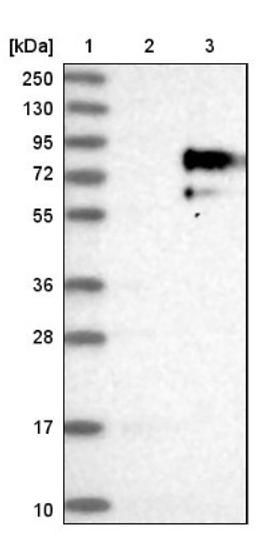 Western Blot: 5T4 Antibody [NBP1-90315] - Lane 1: Marker [kDa] 250, 130, 95, 72, 55, 36, 28, 17, 10<br/>Lane 2: Negative control (vector only transfected HEK293T lysate)<br/>Lane 3: Over-expression lysate (Co-expressed with a C-terminal myc-DDK tag (~3.1 kDa) in mammalian HEK293T cells, LY401995)