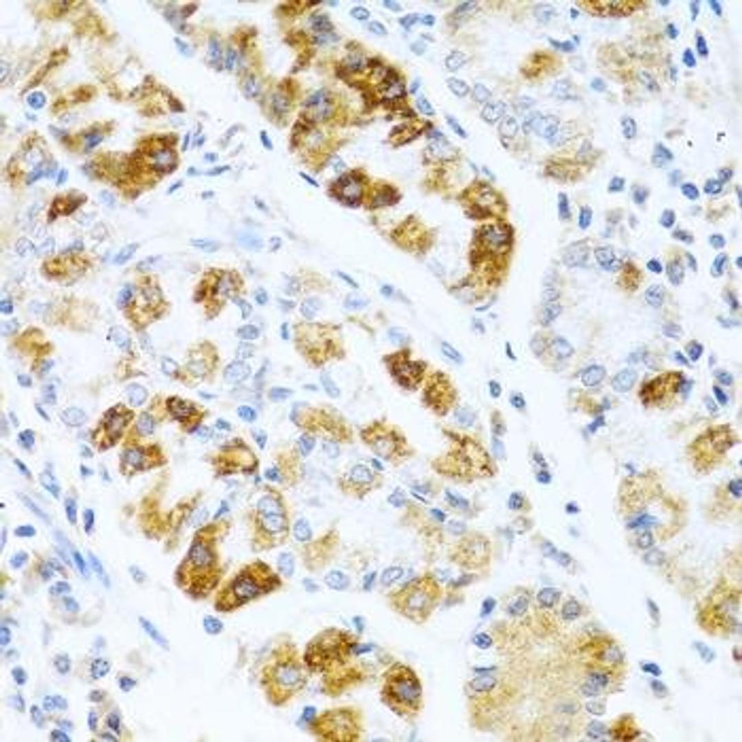 Immunohistochemical staining of rat kidney tissue using BMP3 antibody (dilution of 1:100)