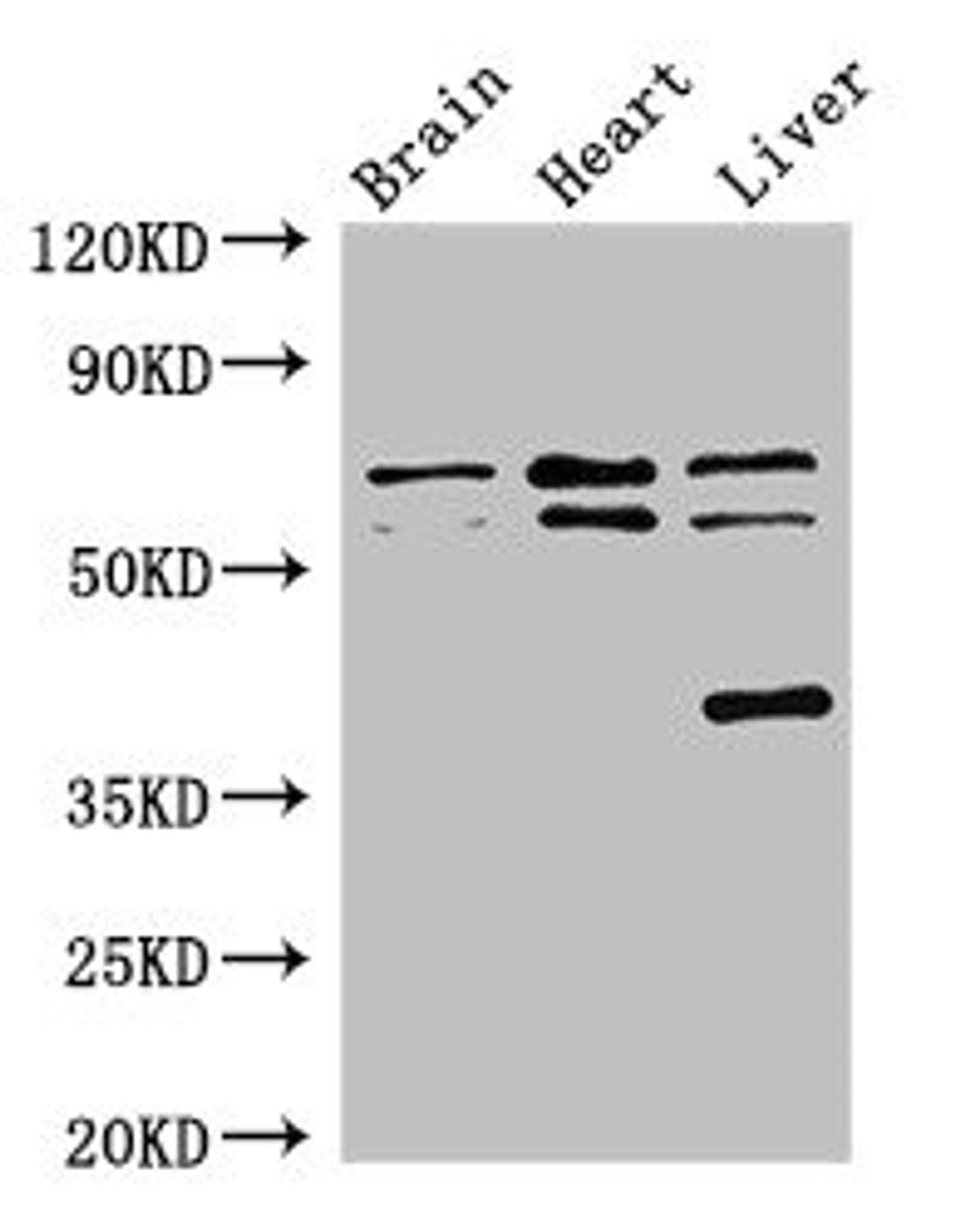 Western Blot. Positive WB detected in: Mouse brain tissue, Rat heart tissue, Rat liver tissue. All lanes: TRAF3IP3 antibody at 2.7ug/ml. Secondary. Goat polyclonal to rabbit IgG at 1/50000 dilution. Predicted band size: 64, 62, 41 kDa. Observed band size: 64, 62, 41 kDa.