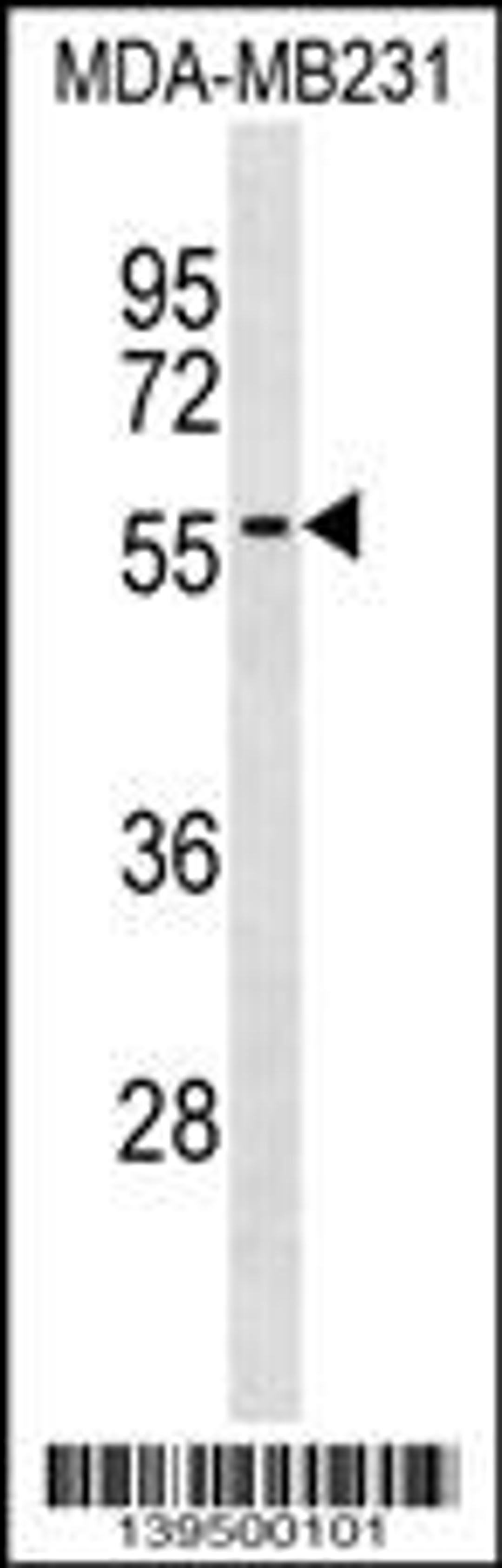 Western blot analysis in MDA-MB231 cell line lysates (35ug/lane).