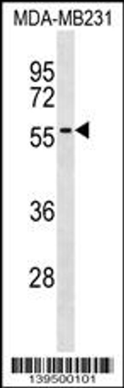 Western blot analysis in MDA-MB231 cell line lysates (35ug/lane).