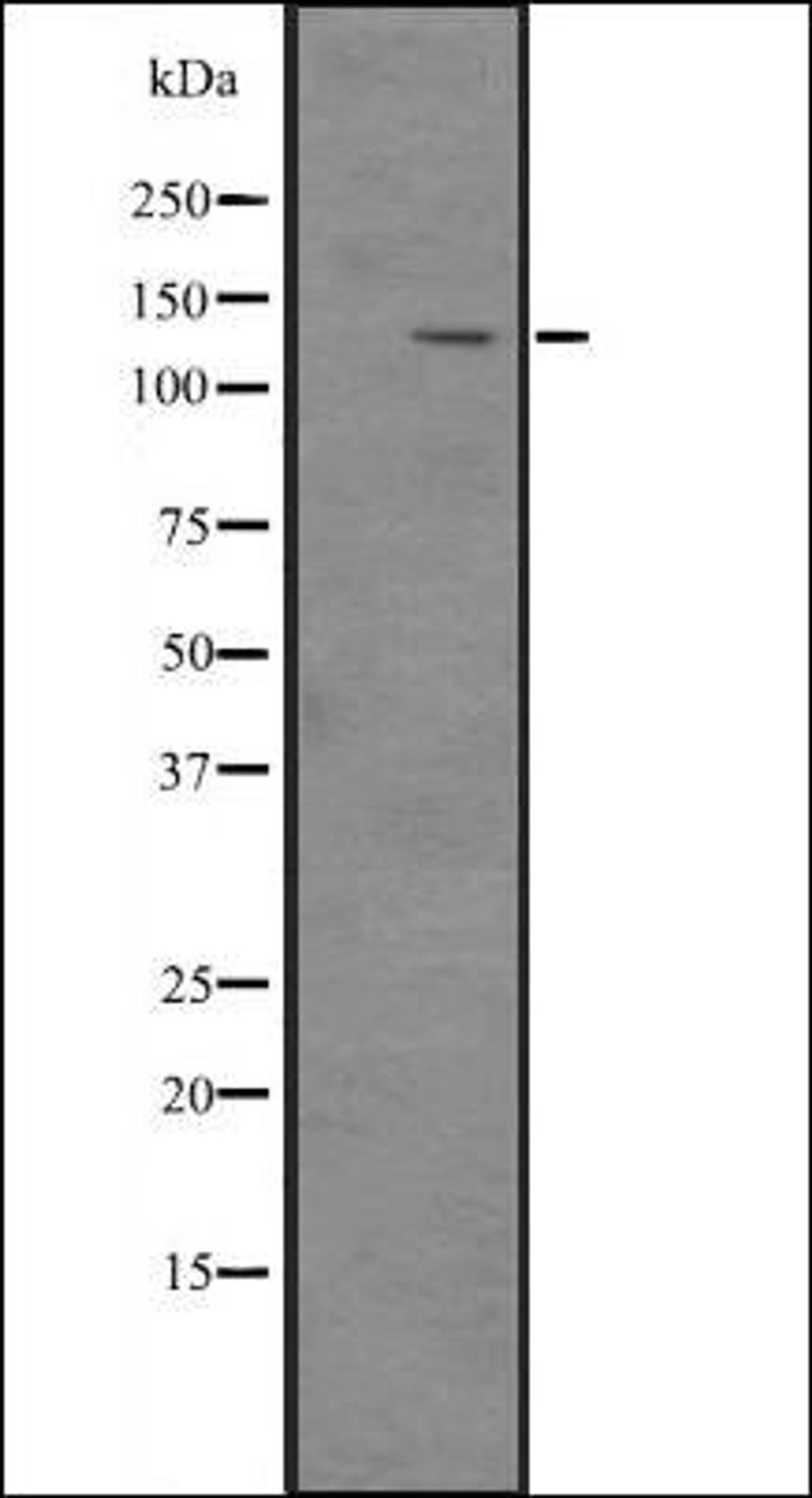 Western blot analysis of Hela cell lysate using ITGA1 antibody