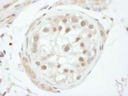 Detection of human GTF2H1 by immunohistochemistry.