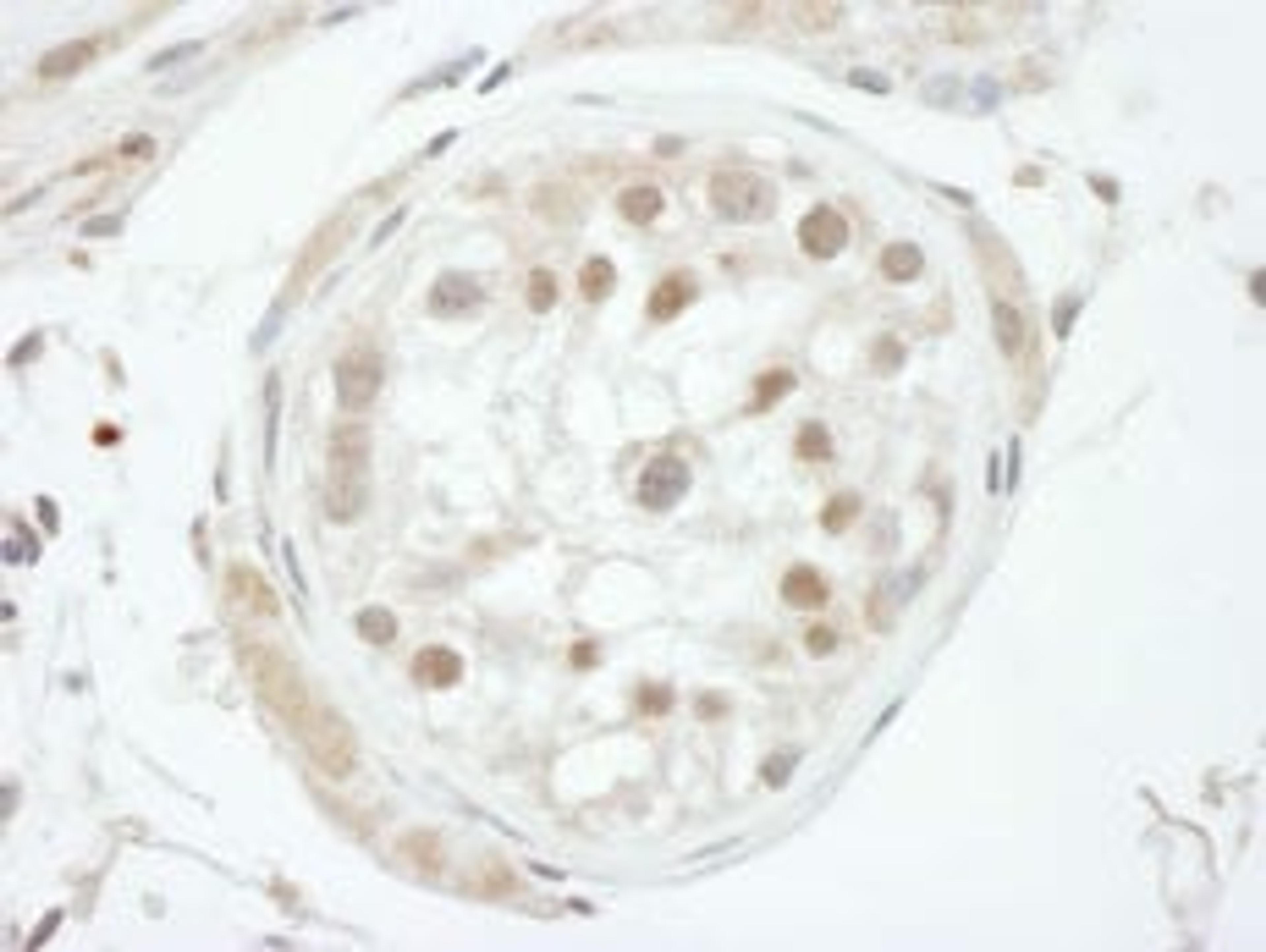 Detection of human GTF2H1 by immunohistochemistry.