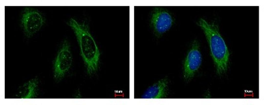 Immunocytochemistry/Immunofluorescence: Cytokeratin 4 Antibody [NBP1-33412] - Sample: HeLa cells were fixed in iced-cold MeOH for 5 min. Green: KRT4 protein stained by Cytokeratin 4 antibody diluted at 1:500. Blue: Hoechst 33343 staining.