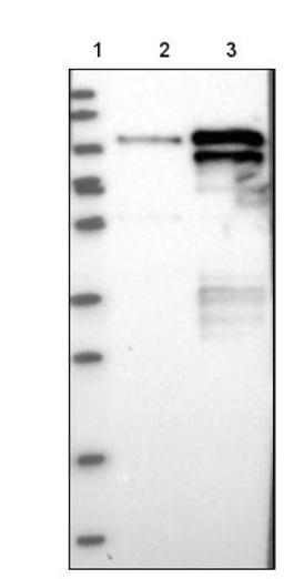 Western Blot: TOX4 Antibody [NBP1-88433] - Lane 1: Marker [kDa] 250, 130, 95, 72, 55, 36, 28, 17, 10<br/>Lane 2: Negative control (vector only transfected HEK293T lysate)<br/>Lane 3: Over-expression lysate (Co-expressed with a C-terminal myc-DDK tag (~3.1 kDa) in mammalian HEK293T cells, LY415032)