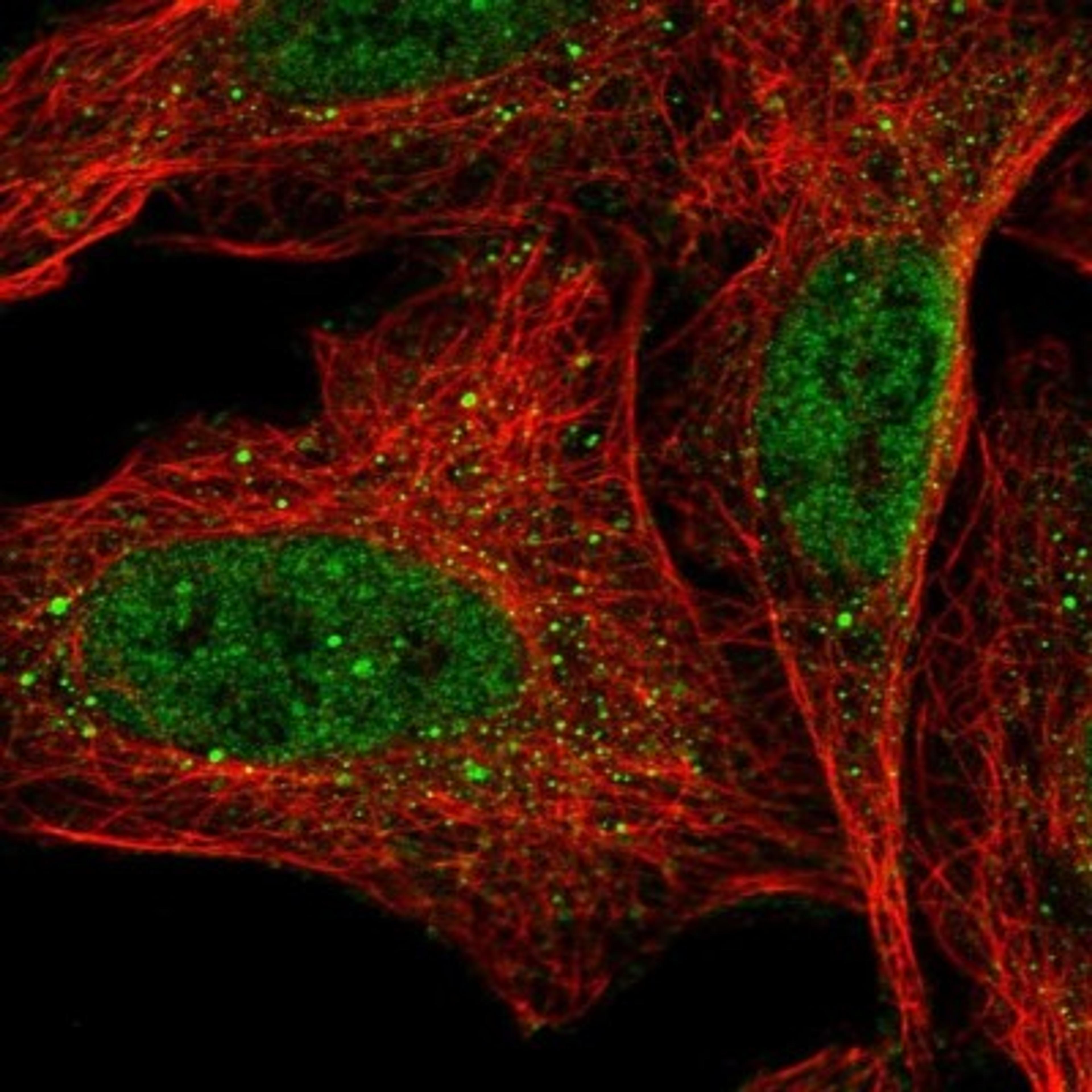 Immunocytochemistry/Immunofluorescence: ZNF490 Antibody [NBP1-81432] - Staining of human cell line U-2 OS shows positivity in nucleus but not nucleoli & vesicles.