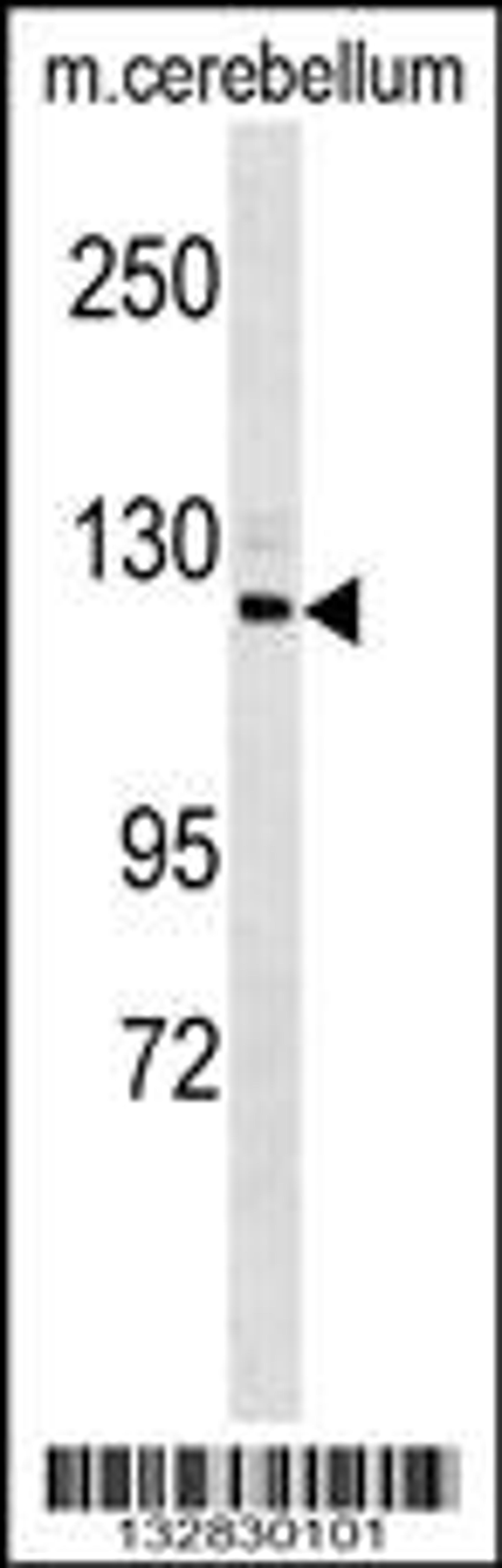 Western blot analysis in mouse cerebellum tissue lysates (35ug/lane).