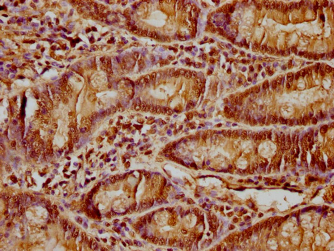 IHC image of CSB-PA010418PA64nacHU diluted at 1:15 and staining in paraffin-embedded human small intestine tissue performed on a Leica BondTM system. After dewaxing and hydration, antigen retrieval was mediated by high pressure in a citrate buffer (pH 6.0). Section was blocked with 10% normal goat serum 30min at RT. Then primary antibody (1% BSA) was incubated at 4°C overnight. The primary is detected by a biotinylated secondary antibody and visualized using an HRP conjugated SP system.