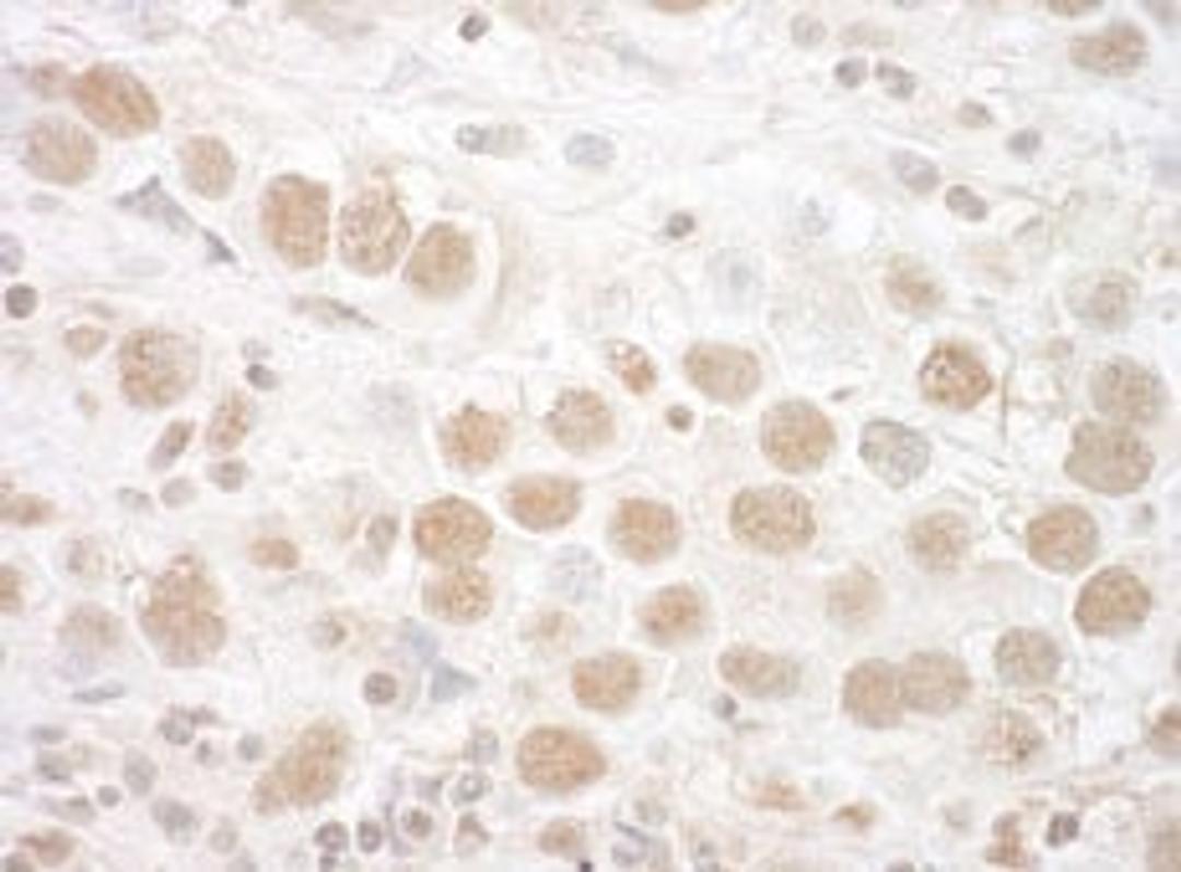 Detection of human CTNNBL1 by immunohistochemistry.