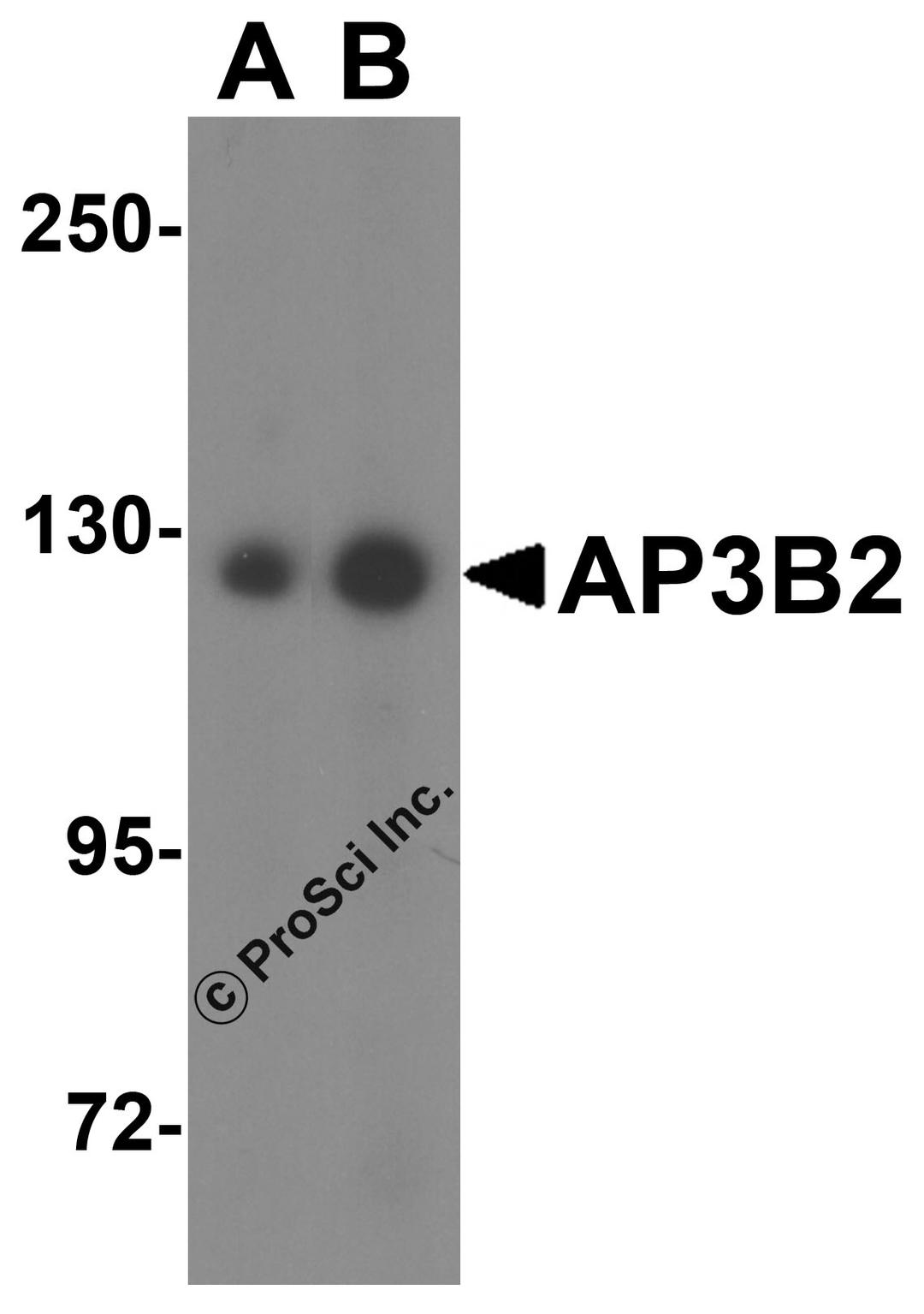 Western blot analysis of AP3B2 in rat brain tissue lysate with AP3B2 antibody at (A) 1 and (B) 2 &#956;g/mL.