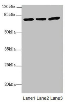 Western blot. All lanes: KBTBD7 antibody at 1.85ug/ml. Lane 1: HL60 whole cell lysate. Lane 2: A549 whole cell lysate. Lane 3: 293T whole cell lysate. Secondary. Goat polyclonal to rabbit IgG at 1/10000 dilution. Predicted band size: 77 kDa. Observed band size: 77 kDa.