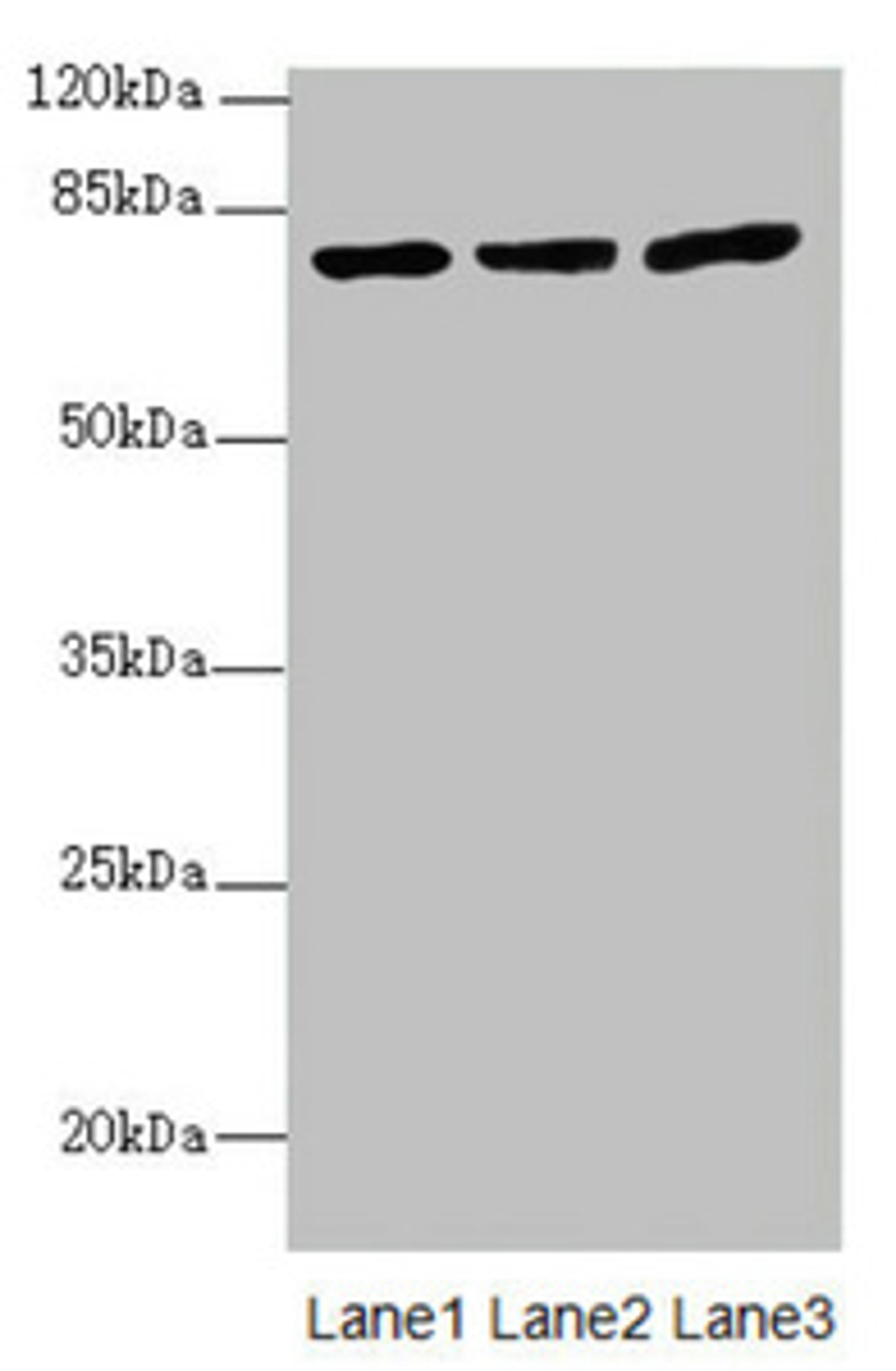 Western blot. All lanes: KBTBD7 antibody at 1.85ug/ml. Lane 1: HL60 whole cell lysate. Lane 2: A549 whole cell lysate. Lane 3: 293T whole cell lysate. Secondary. Goat polyclonal to rabbit IgG at 1/10000 dilution. Predicted band size: 77 kDa. Observed band size: 77 kDa.