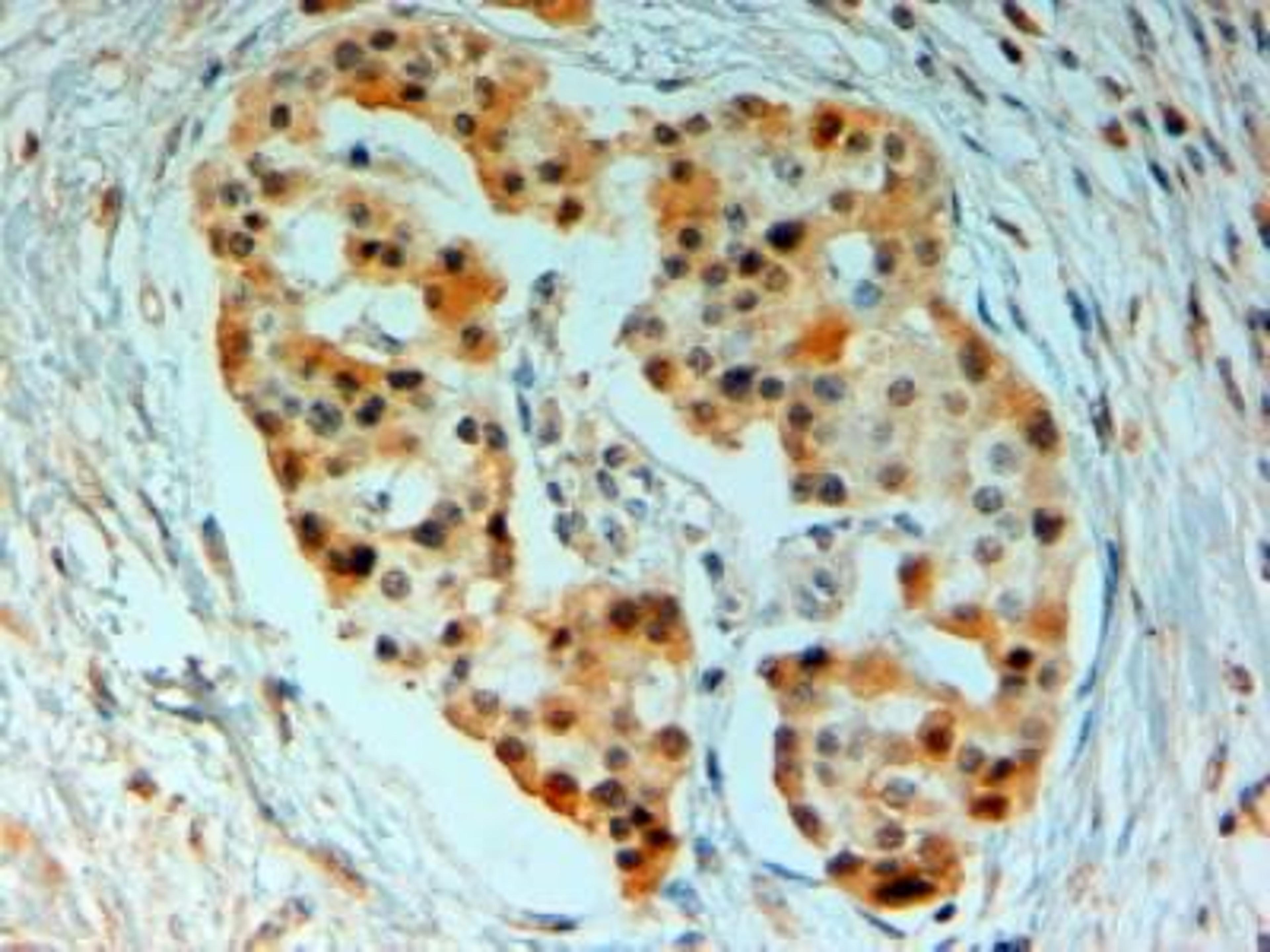 Immunohistochemistry-Paraffin: SIRT4 Antibody [NB100-1406] - (2ug/ml) staining of paraffin embedded Human Pancreas. Steamed antigen retrieval with citrate buffer pH 6, AP- staining.