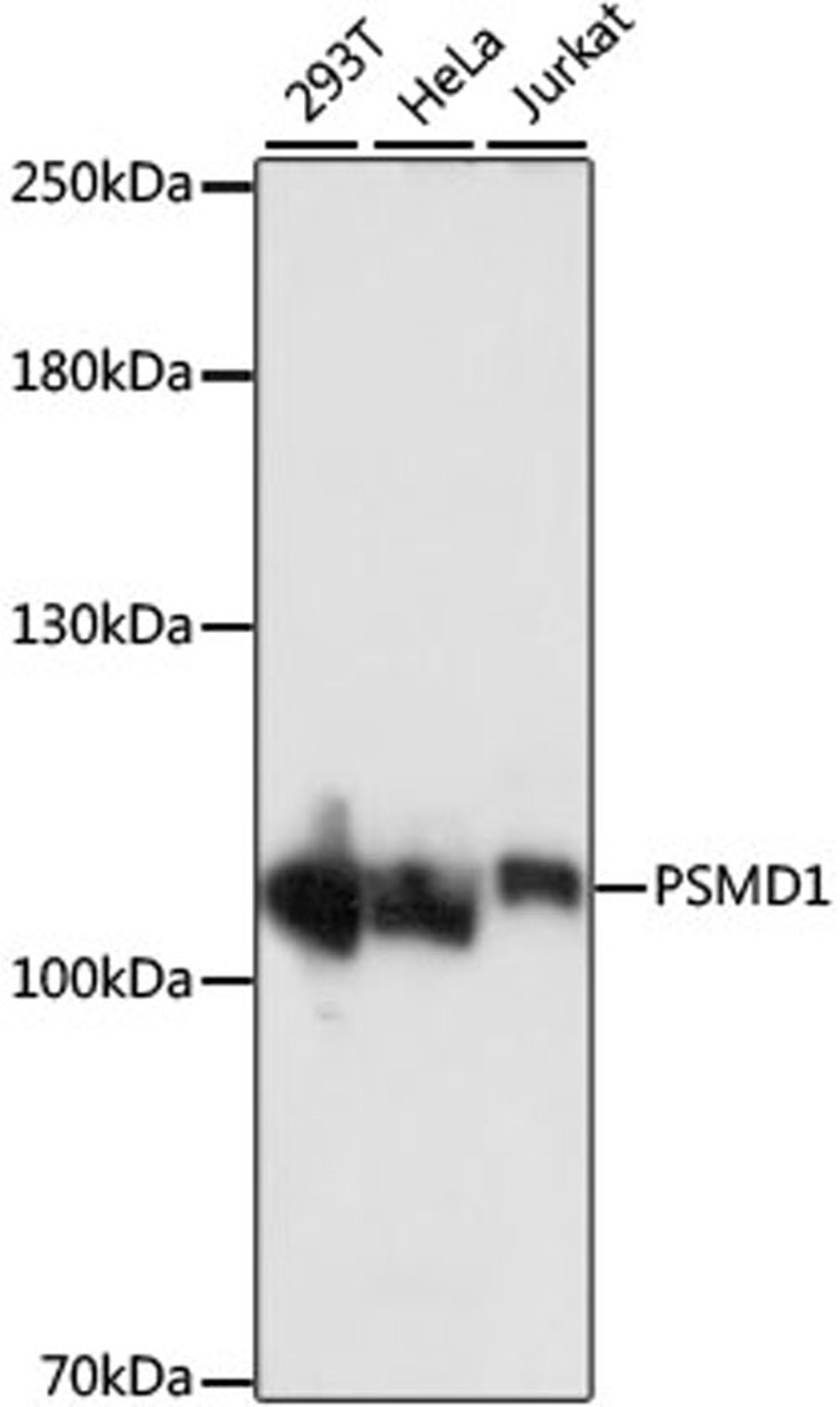 Western blot - PSMD1 antibody (A16420)