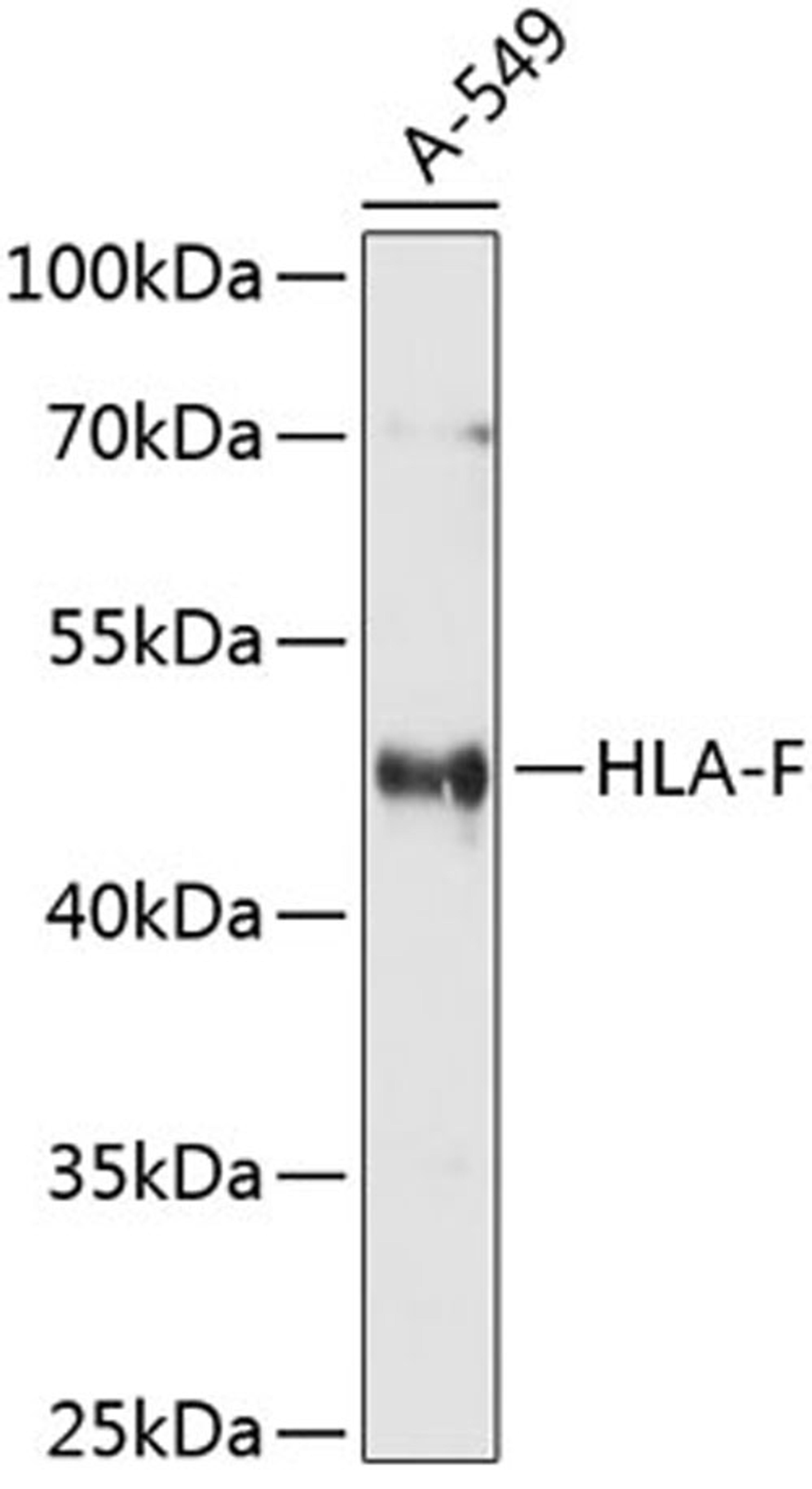 Western blot - HLA-F antibody (A10384)